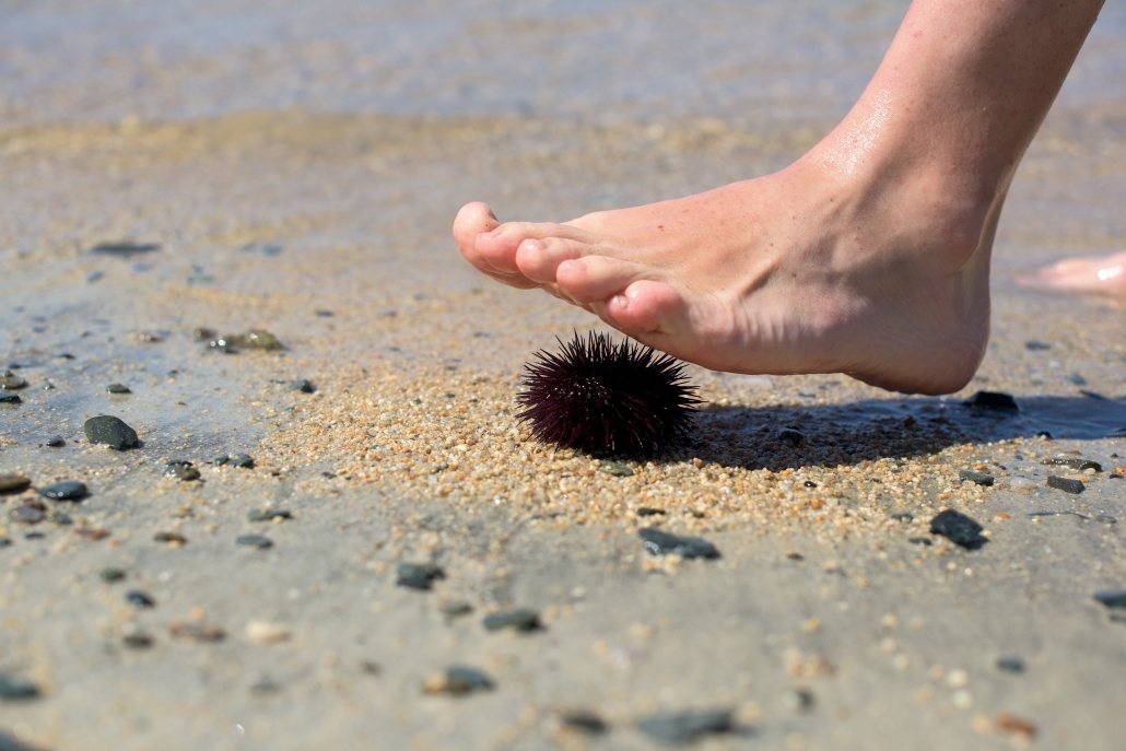plantar fasciitis foot pain