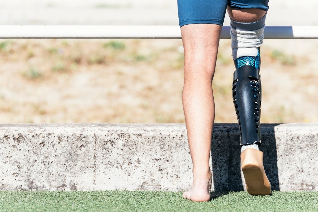phantom limb pain as it relates to back pain