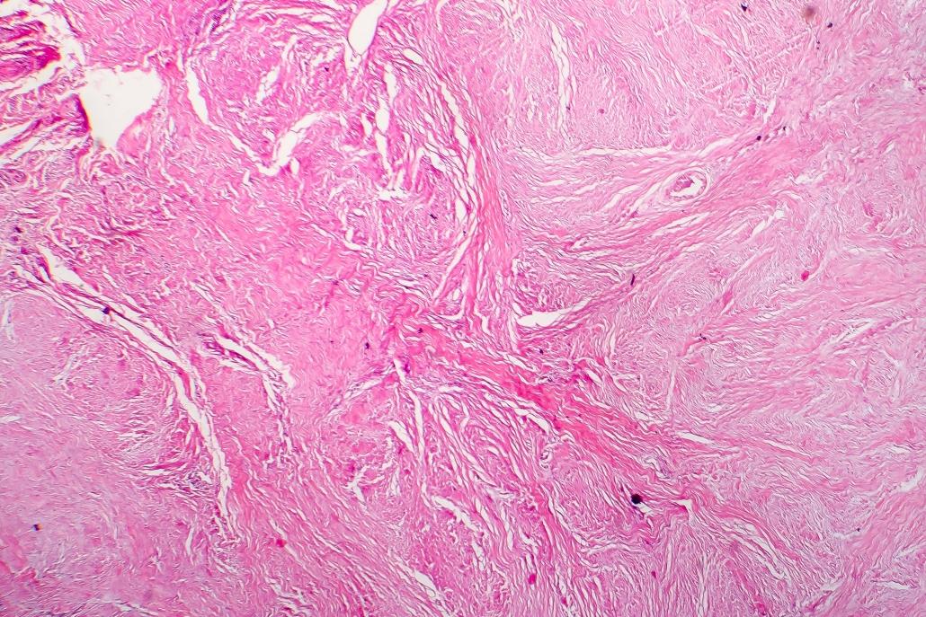 to illustrate scar tissue which is not traditionally treated by podiatrists