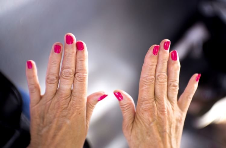 Osteoarthritis