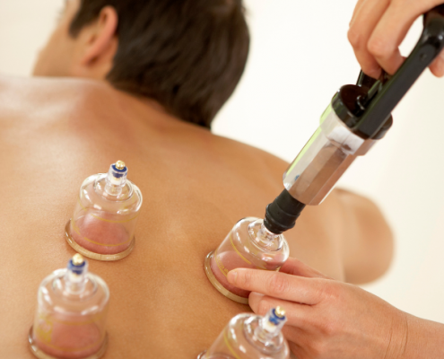 pain, chronic pain, shoulder pain, acute pain, hip pain, soreness, cupping, cupping therapy, painful, foot pain