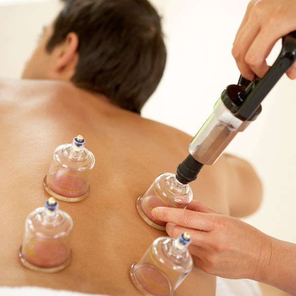 Read more about the article Cupping Therapy For Low Back Pain: What To Expect?