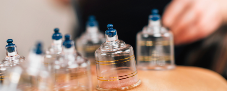 Cupping - Drawing & Eliminating Inflammation